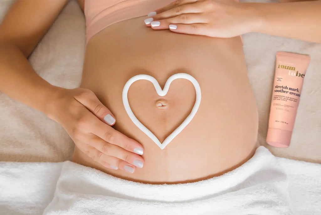 How to Treat Stretch Marks in Pregnancy